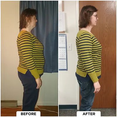 Chiropractic-renton-wa-before-after