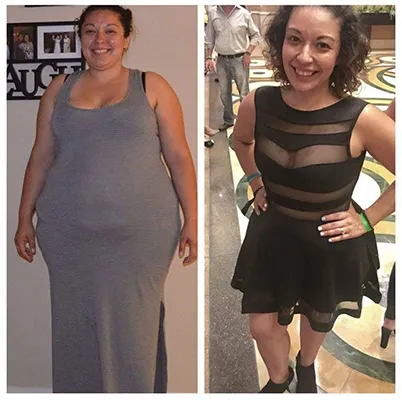 Chiropractic-renton-wa-confident-before-after