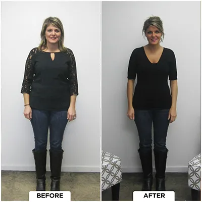 Chiropractic-renton-wa-lady-before-after