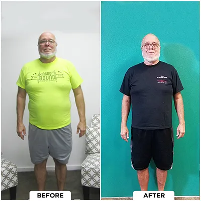 Chiropractic-renton-wa-male-before-after