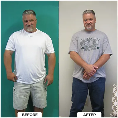 Chiropractic-renton-wa-man-before-after