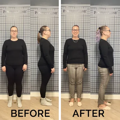 Chiropractic-renton-wa-new-before-after