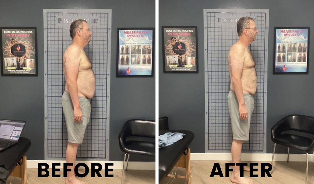 Weight loss